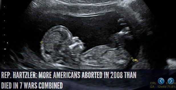 Abortion Genocide!