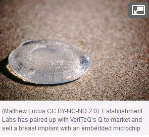 Microchip Implants