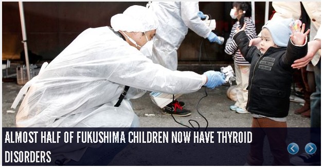 over 40 percent of fukushima children have thyroid disorders